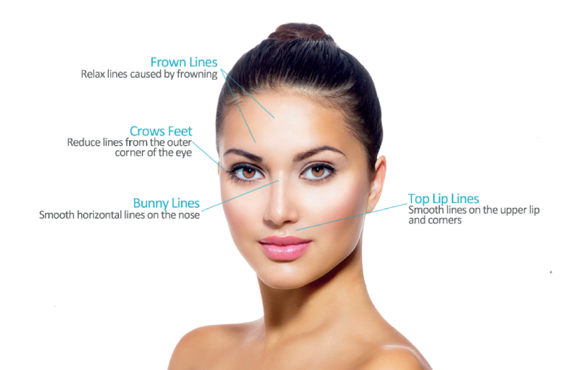 Anti wrinkle injections 1