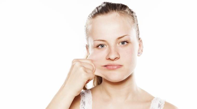 CHEEK IMPLANT2