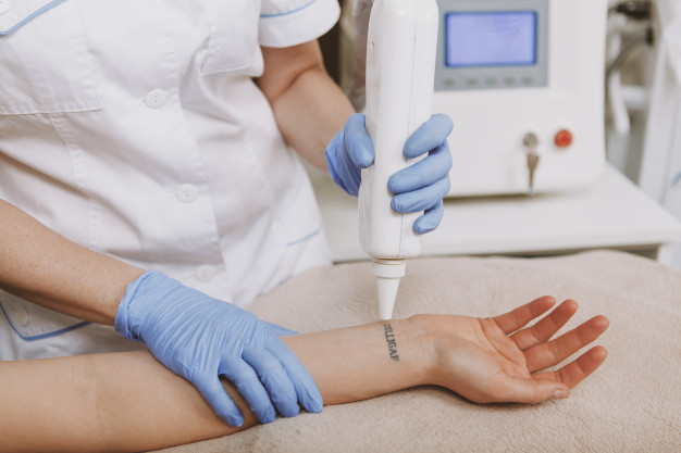 LASER TATTOO REMOVAL TREATMENT3