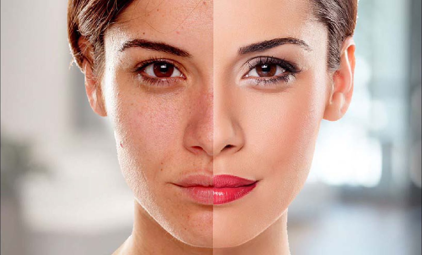 Skin Whitening Treatment1