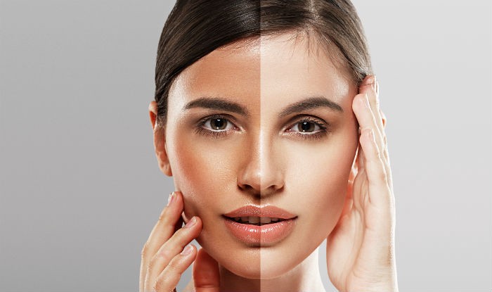 Skin Whitening Treatment4