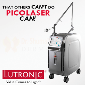 Discover State-of-the-Art Aesthetic Equipment at Dermalase, Islamabad 6 Pico Laser in islamabad