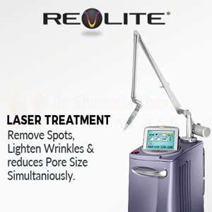 Discover State-of-the-Art Aesthetic Equipment at Dermalase, Islamabad 3 Revlite Laser islamabad