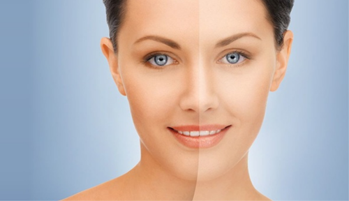 Complexion brightening treatment1
