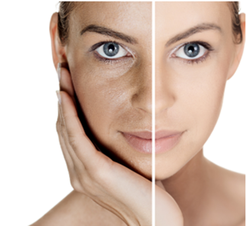 Complexion brightening treatment34