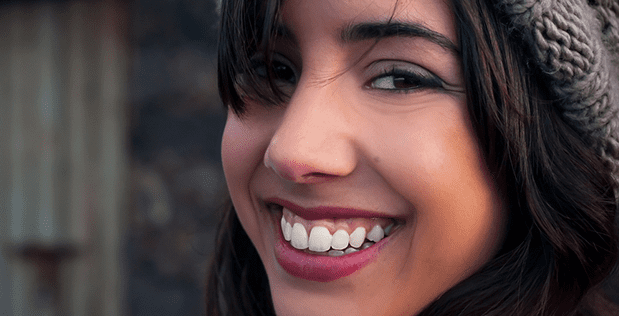 Gummy smile correction2