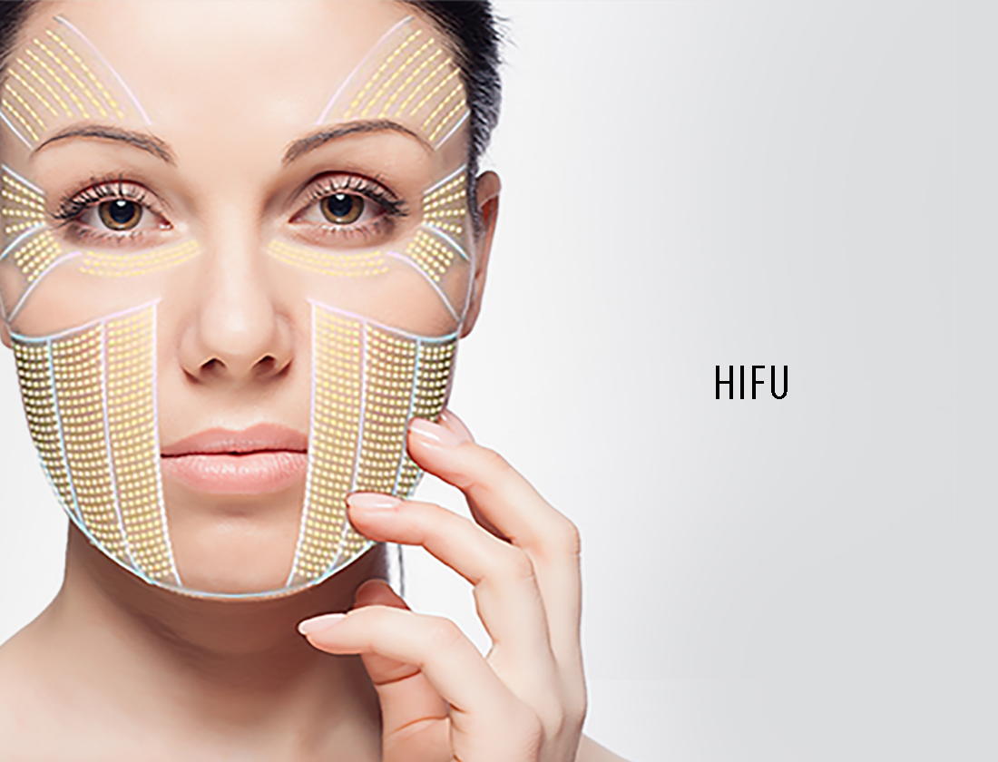 HiFU treatment1