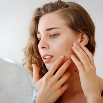How Seasonal Change Affects Your Skin and What to Do During Early Spring According to Dermatologists 2 Pigmentation treatment in islamabad - best dermatoligst in islamabad dr. shumaila khan