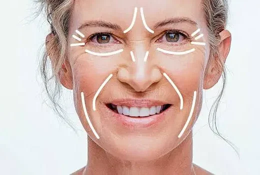 Cheap Liquid Face Lift in islamabad by Dr.Shumaila khan at dermalase clinic in Islamabad pakistan.
