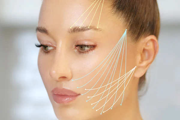 A thread lift is a non-surgical face-lifting procedure. Thin, medical-grade dissolvable threads are inserted just under the skin using a fine needle or cannula.